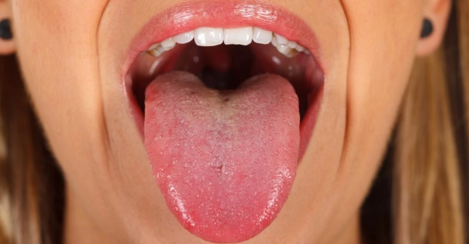 Salty Taste in Mouth 2